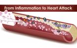 微粒子可阻止心脏病发作引起的炎症