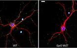 PNAS：从DNA到疾病，科学家发现了罕见脑部疾病的突变机制