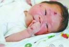 羊水屏障：让车祸撞出的胎儿奇迹存活