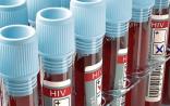 WHO：HIV治疗停滞不前的根本原因，竟然是……