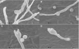 PLoS Pathog：感染艾滋病患者的致命真菌竟“长”在树上