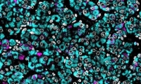 PLOS Biology：“小弟弟”发育需要的不只是睾丸与雄激素！