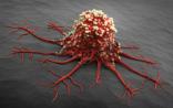 精准癌症治疗：上百个致癌突变-药物组合被揭示