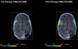 15年换来“首次”！《科学》子刊免疫疗法突破：新技术让你“看见”T细胞