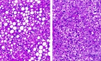Science重磅：神奇分子，让你“瞎吃不胖”