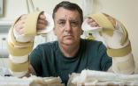 全球首例“双手移植”！英国男子手术成功