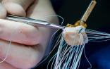 中国首例3D打印技术导航TAVI手术在复旦大学附属中山医院完成