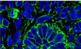 重要里程碑！科学家利用人多能干细胞造出“人工肾”