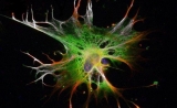 缩短至2周！新方法可快速利用干细胞培养脑细胞