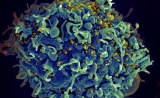 为何HIV感染者患癌风险更高？