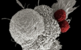 攻击白血病的改良T细胞成为美国第一个批准的基因治疗