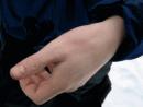 全球抗帕金森病药物研发：新型制剂为主导