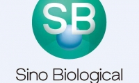 Nature重磅文章发现B细胞内抗体产生的新机制：染色质环挤压