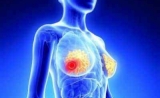 乳腺癌新药！诺华Kisqali获欧盟CHMP推荐，成首个一线治疗绝经前中后的CDK4/6抑制
