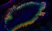 Science关注：超声波可以“看到”肿瘤细胞何时打开和关闭基因