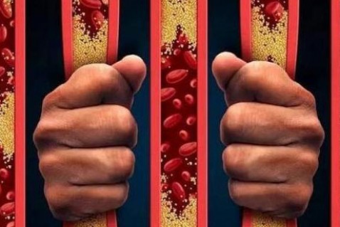 身体向你发出的血栓求救信号，收到1个就能救命