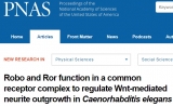 遗传发育所揭示神经突生长调控新机制 | PNAS