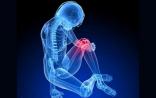 Pain Medicine：腰酸背痛，莫怪天气