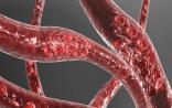 Nature：中国科学家揭示动脉粥样硬化形成机制