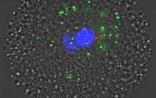 PNAS：遗传学研究新发现！或可用于治疗线粒体疾病