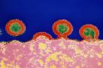 Nature报道：人类有希望从体内彻底清除HIV病毒
