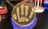 新作用！Science子刊：这种细菌可以预防皮肤癌