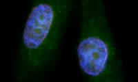 PNAS：科学家找到“癌中之王”胰腺癌的潜在联合疗法