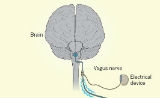 Nature：电刺激激活免疫系统疗法