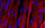 eLife：科学家首次培育出可收缩肌肉