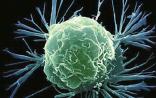 PNAS：跟踪癌症进展的新方法