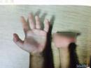 产检6次都OK，孩子出生后右手却一根手指都没有！关于产检B超，你该了解这些