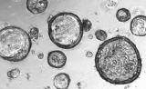 新的“癌症替身”！Science：肿瘤类器官可预测患者对药物的反应