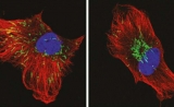 Nature子刊：阻断线粒体这一分子途径，可以降低乳腺癌侵袭性