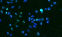 癌症治疗为何容易耐药？Science：癌细胞利用DNA复制出错“求生”