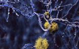 Nature封面：抗体药物再攻一城！老年痴呆临床数据喜人