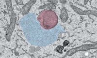 Cell | 渐冻症新机制被揭示：致病基因阻碍了神经元中RNA“搭便车”