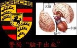 关注脑干出血：保时捷中国高管李屹44岁病逝