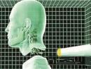 人类首例头颅移植手术可能将在明年进行