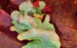 Nature重磅成果：科学家首次揭秘“皮肤癌”细胞起源