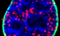 Nature子刊：从抑癌基因到致癌基因，这个蛋白有“两副面孔”