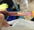 16岁少年生命即将终止，根源竟是父母的溺爱