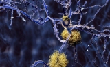 首个！Nature：冷冻电镜解析痴呆蛋白高清结构