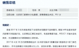 患癌后，我奔波于国内多家医院，给出了截然不同的方案
