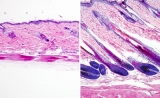 Nat Cell Biol：乳酸可以刺激干细胞，让毛发再生！