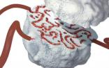 Science故事：“饿死”癌细胞遭到威胁？ 一场持续了近17年的争议始末