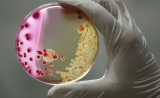 中国科学家发现“吃塑料”真菌