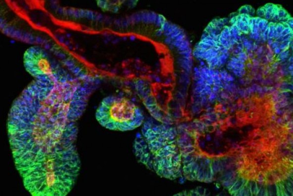 Science重磅推出：“类器官”研究愈发重要，可预测癌症药物反应