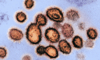 Science重磅：WHO举全球之力，寻找COVID-19特效药！