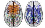 PNAS: 大脑神经联结揭开男女思维差异