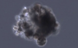 多亏了CRISPR，科学家灭了所有癌变基因